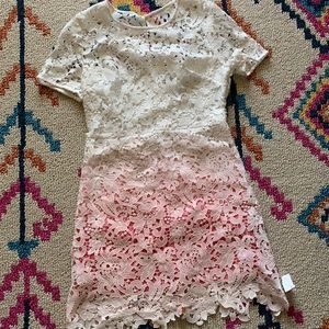 💕Lace Dress💕